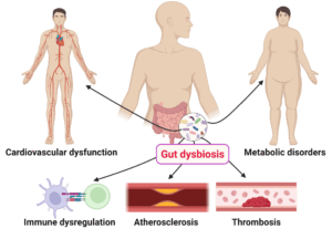 a technical illustration of gut dysbosis